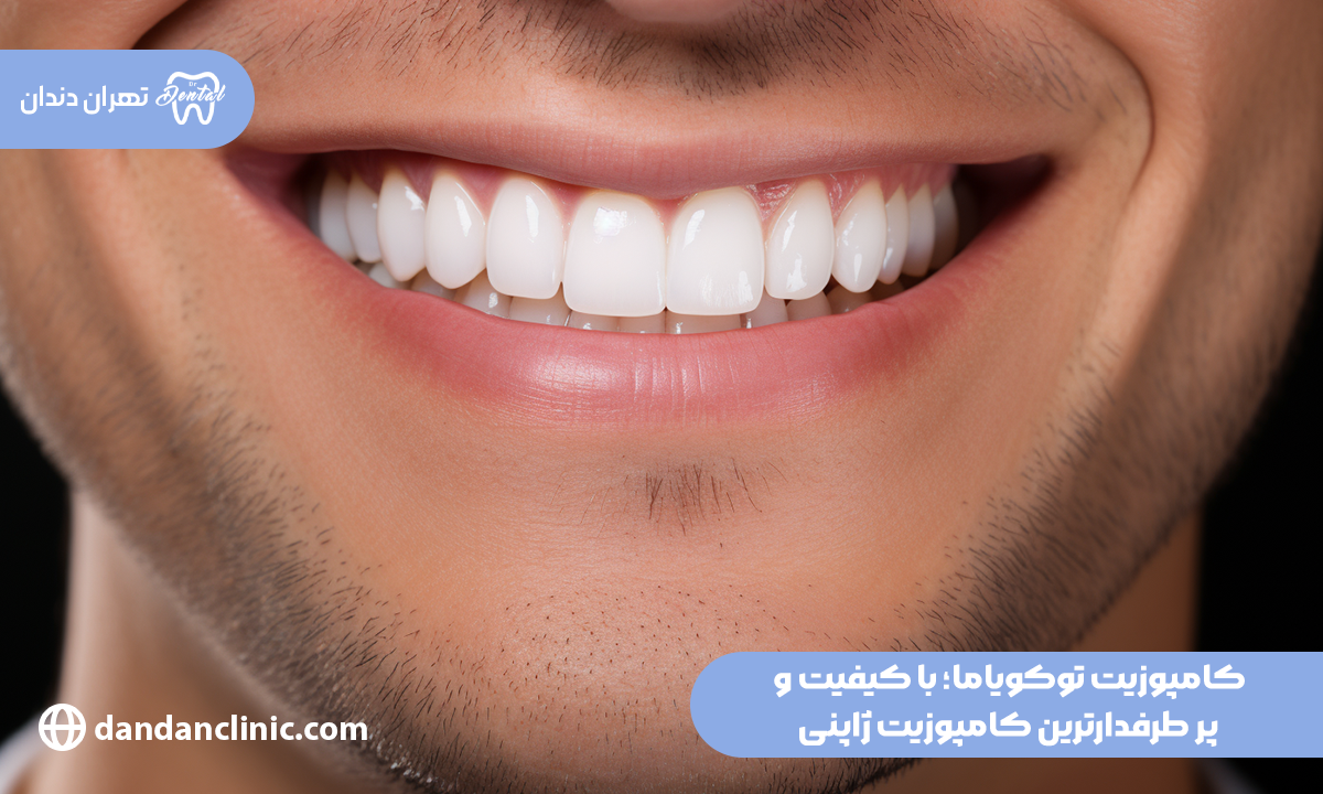 کامپوزیت توکویاما؛ با کیفیت و پر طرفدارترین کامپوزیت ژاپنی